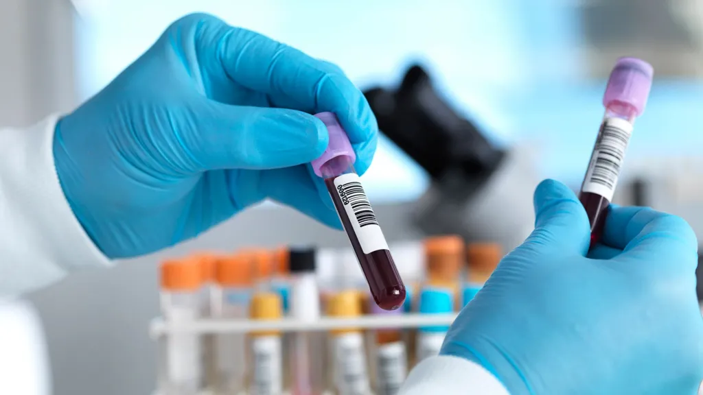 Blood sample tubes awaiting analysis in a laboratory
