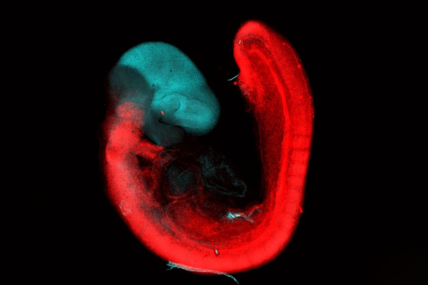 9.5-day-old mouse embryo: forebrain and midbrain stained in blue, hindbrain and spinal cord in red