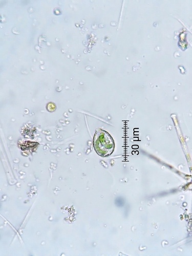 Paulinella chromatophora 活体