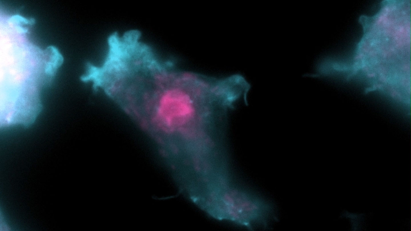 Microscope image of Naegleria amoebae under experimental observation