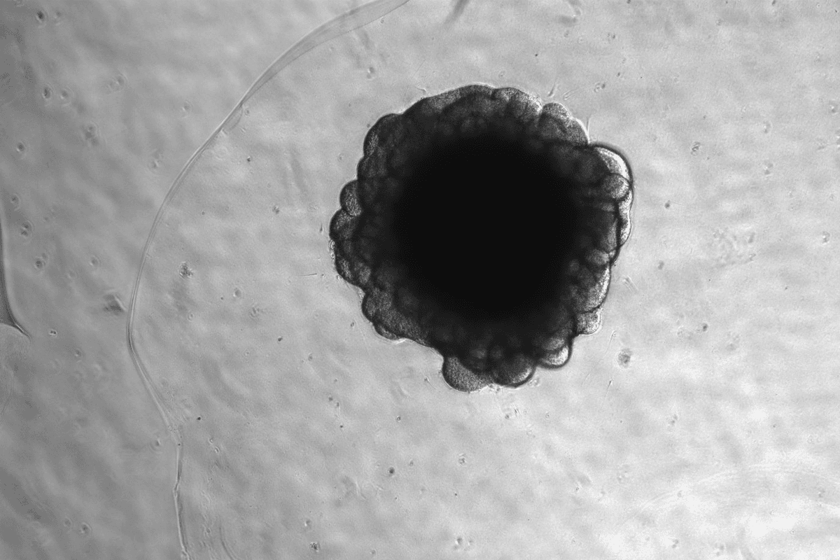 Chimpanzee neural organoid microscopic image