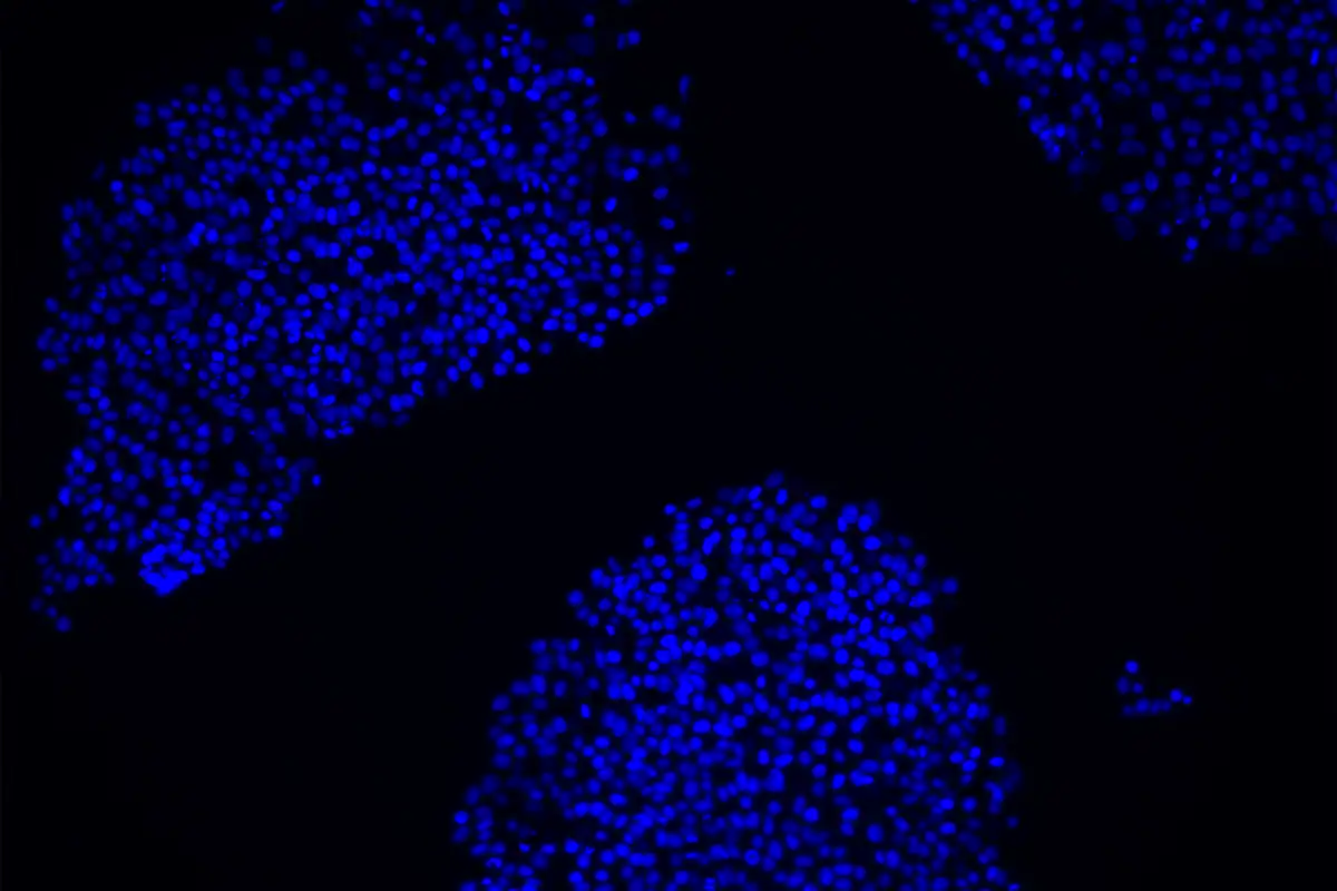 Chimpanzee induced pluripotent stem cells
